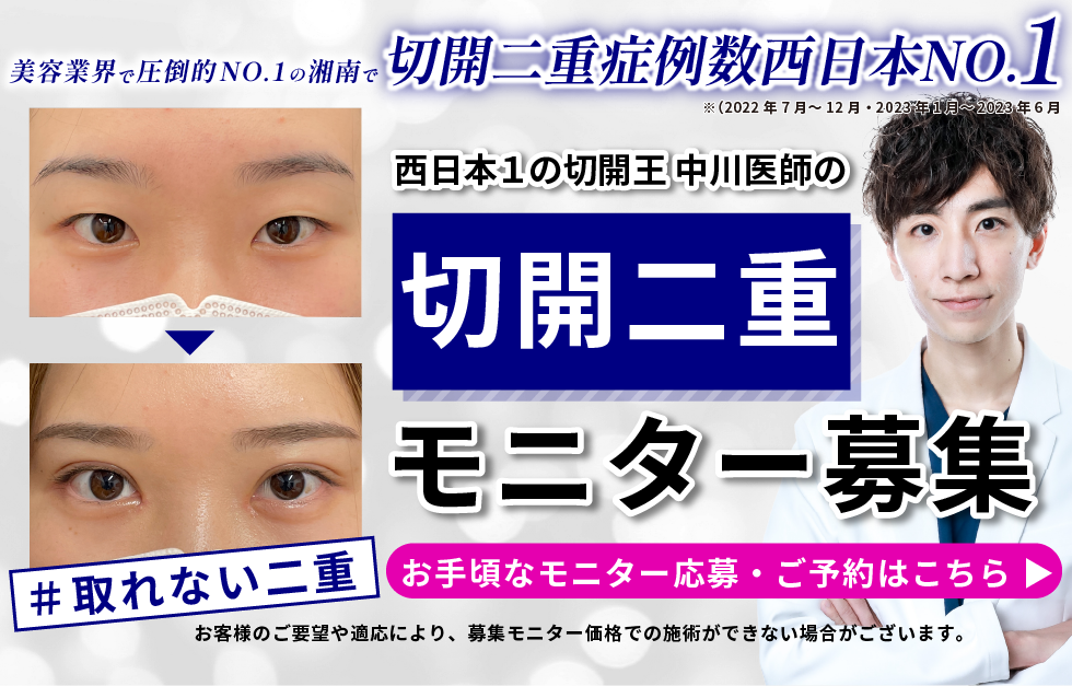 切開二重モニター募集