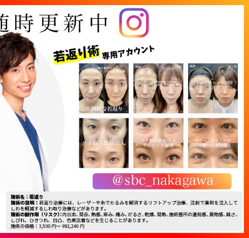 Instagram若返り