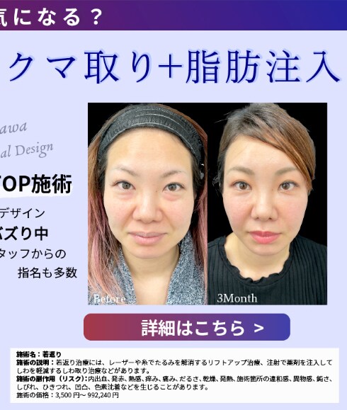 クマ取り脂肪注入モニター