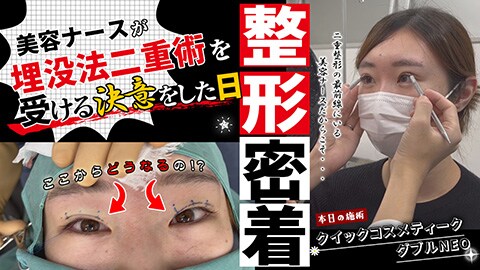 整形密着2