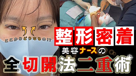 整形密着1