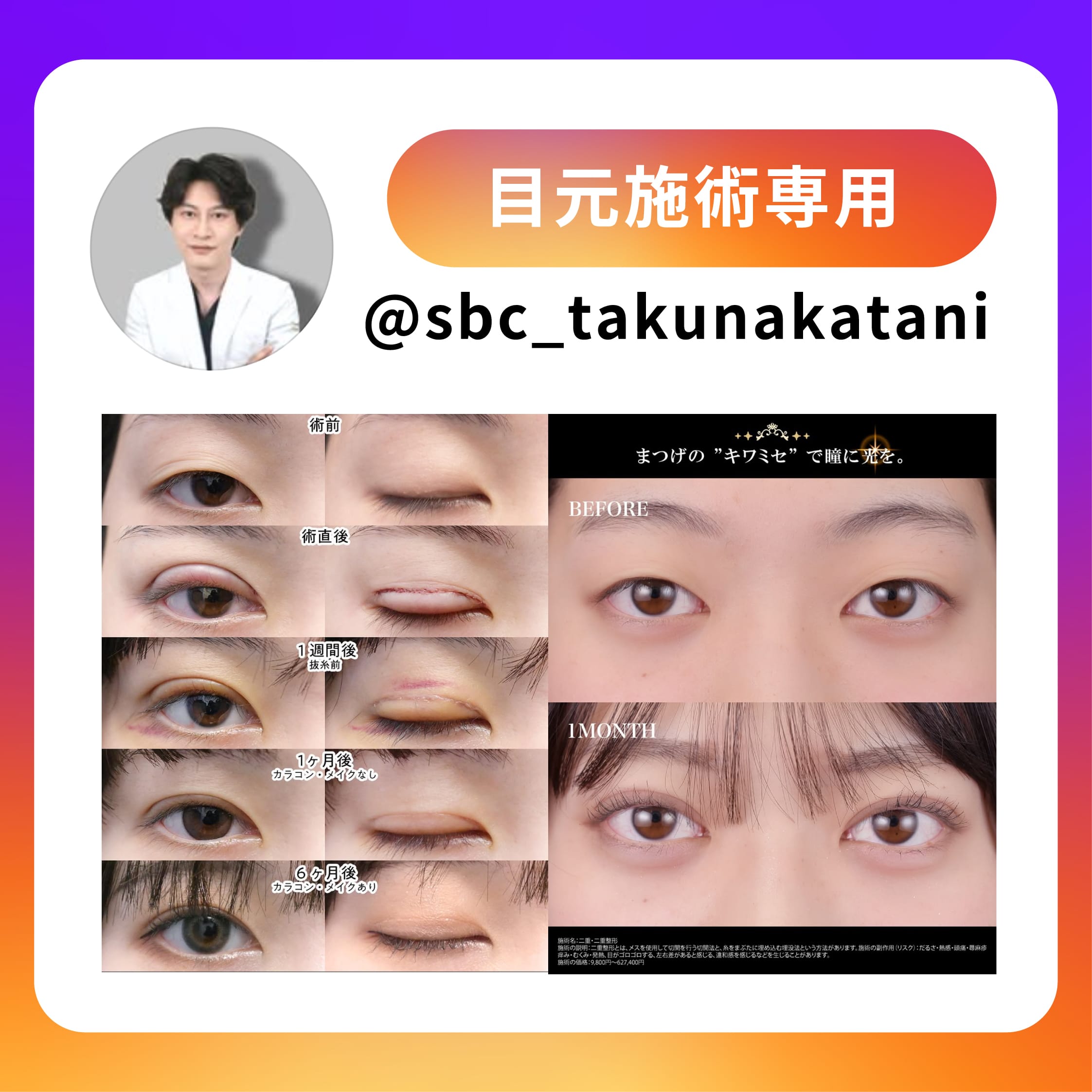 目元instagram