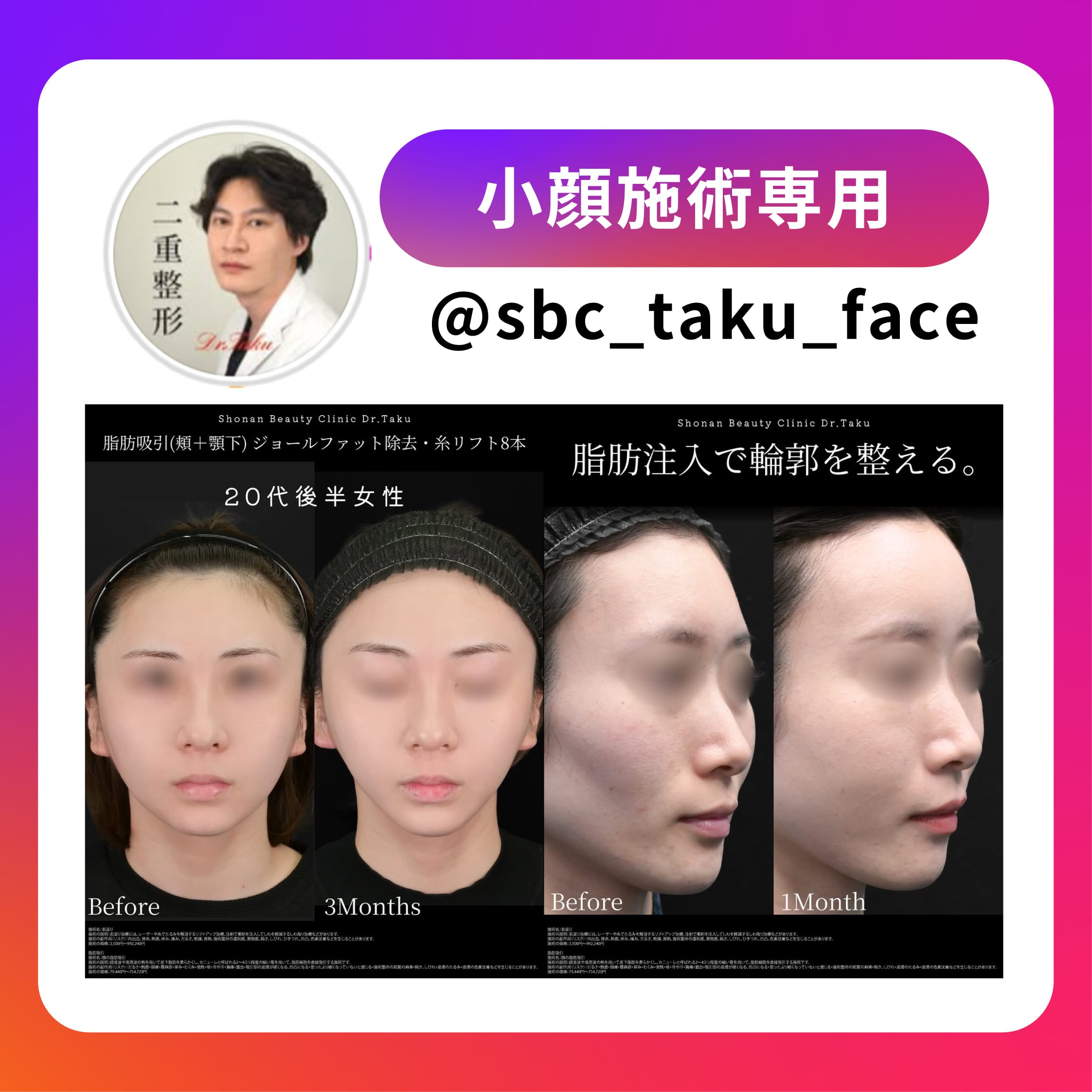 小顔instagram
