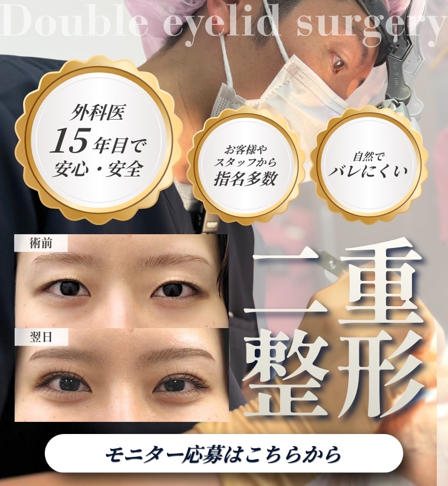 二重整形モニター