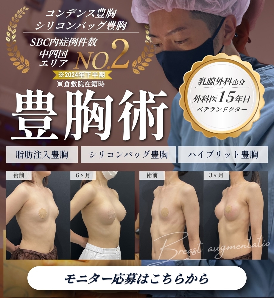 豊胸モニター