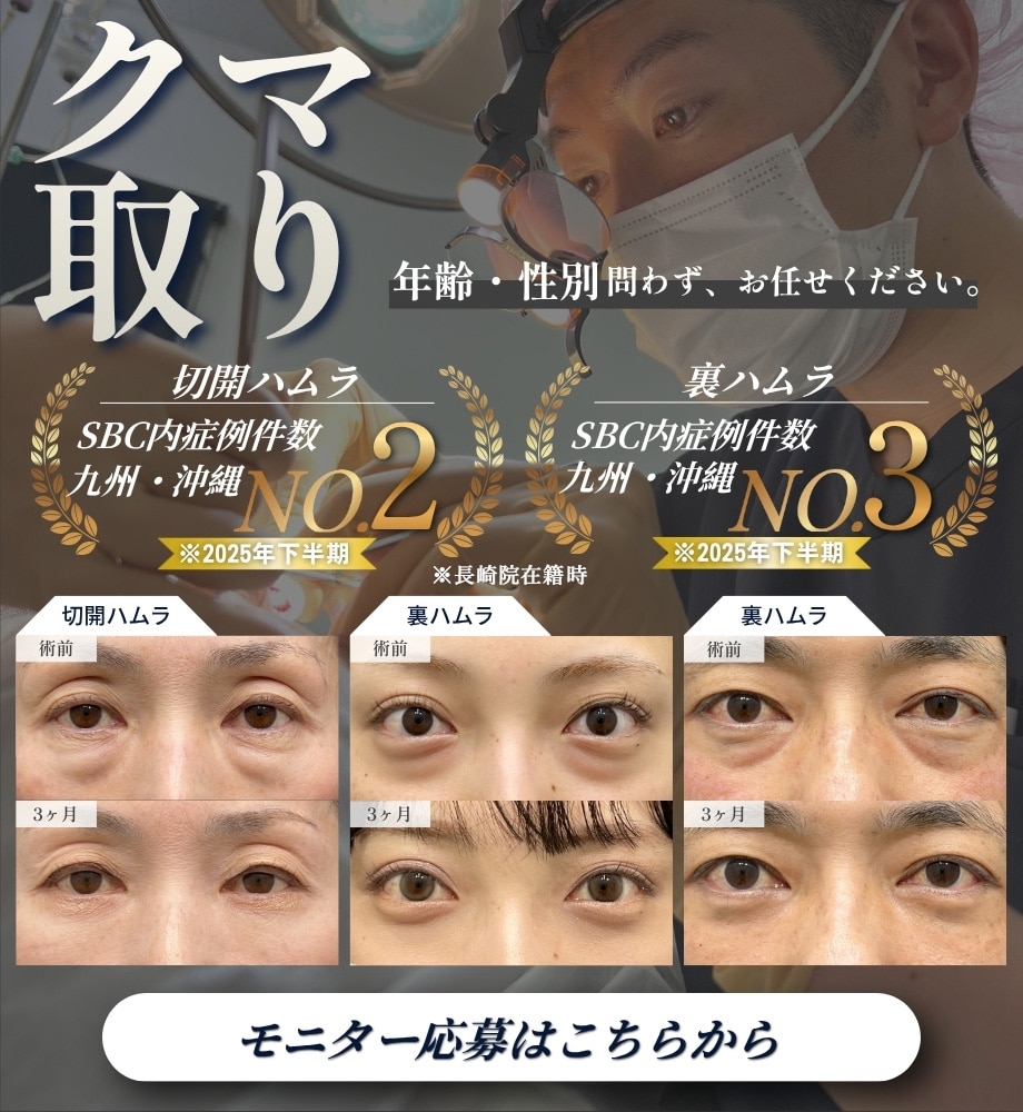 クマ取りモニター