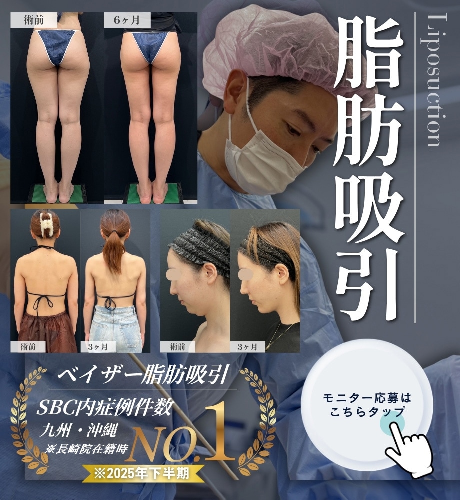 脂肪吸引モニター