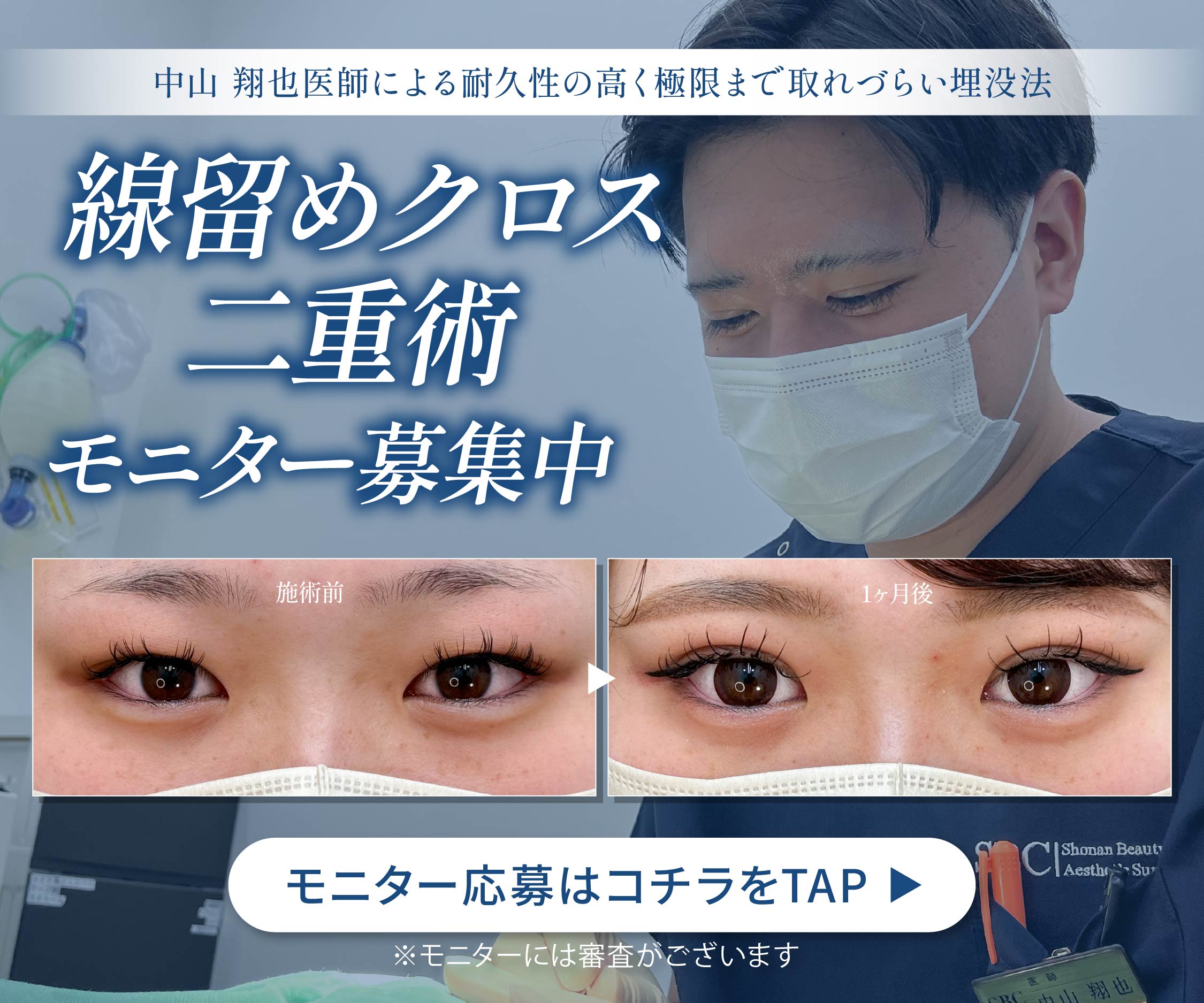 二重術モニター募集