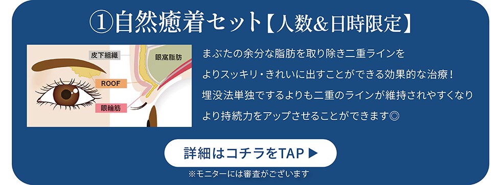 自然癒着セット