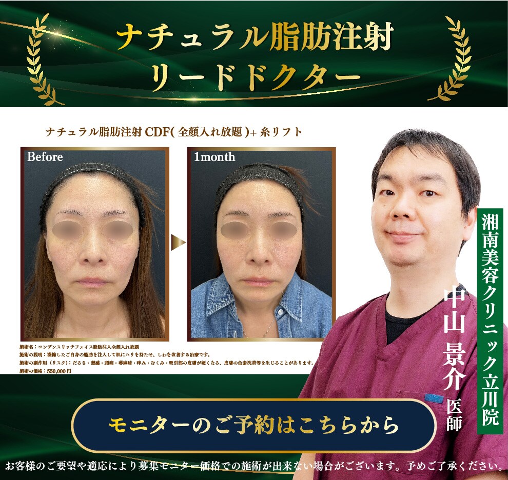 若返り