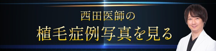 症例