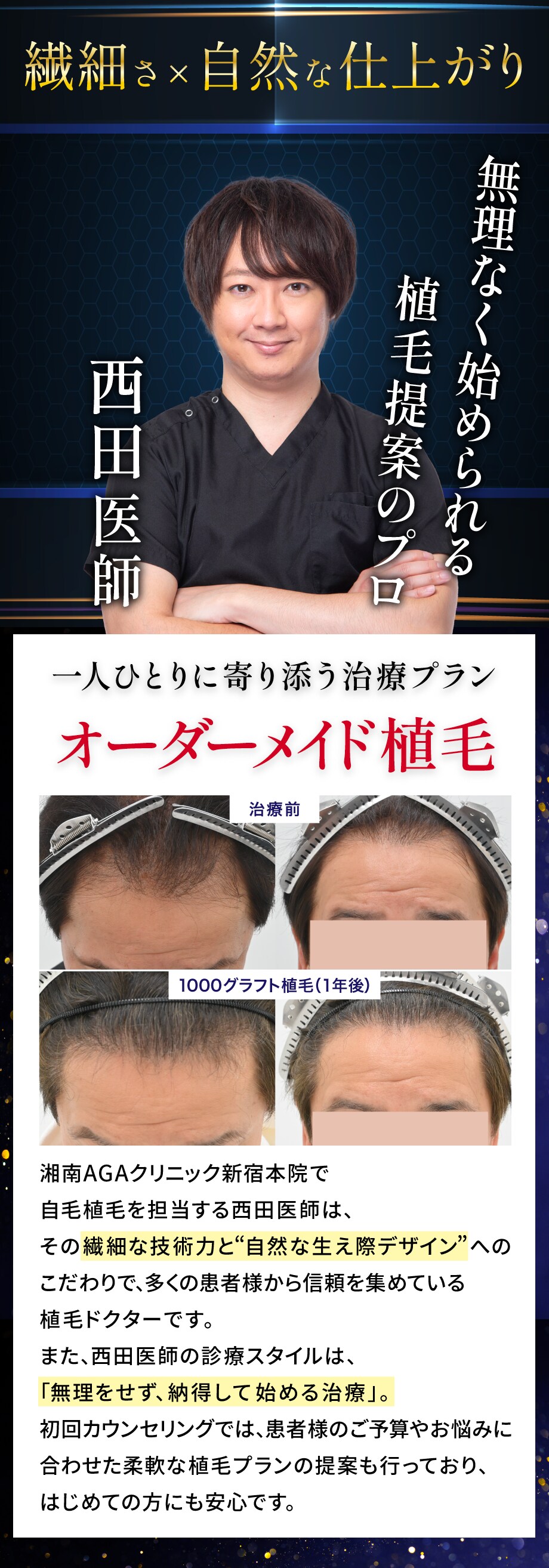 二重術モニター募集