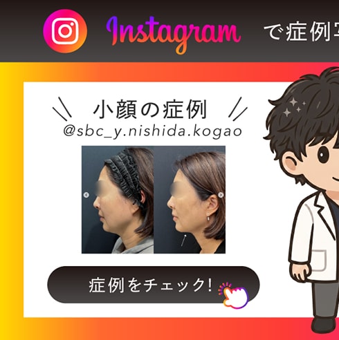 Instagram 小顔