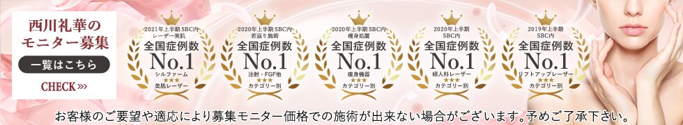 モニター募集