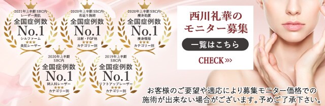 モニター募集