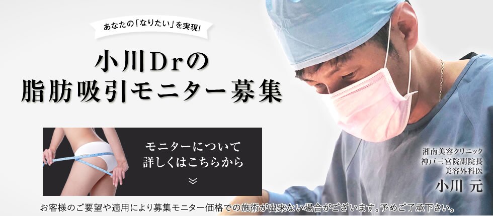 脂肪吸引モニター募集