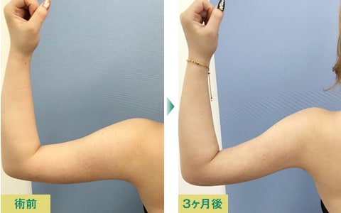 年の確かなセンスと実力 美容整形 美容外科 美容皮膚科なら湘南美容クリニック 公式 年の確かなセンスと実力 美容整形 美容外科 美容皮膚科なら湘南美容クリニック 公式