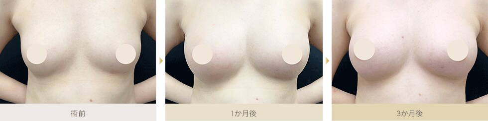 症例写真1