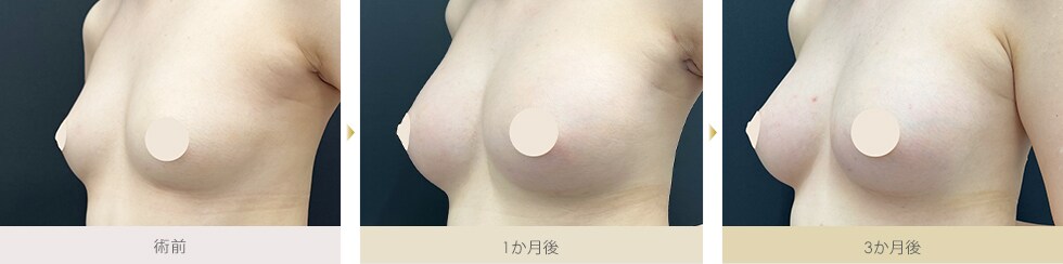 症例写真2