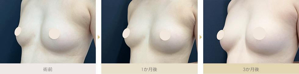 症例写真1