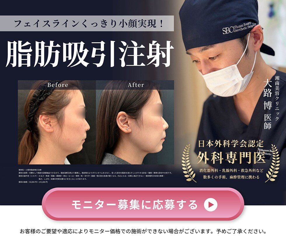 脂肪吸引注射