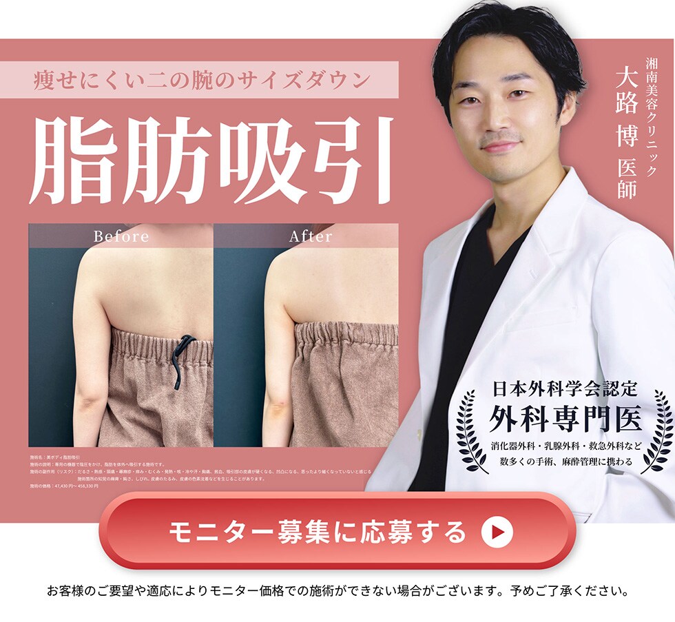 脂肪吸引