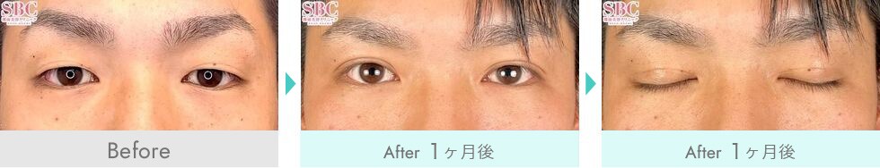 症例写真2