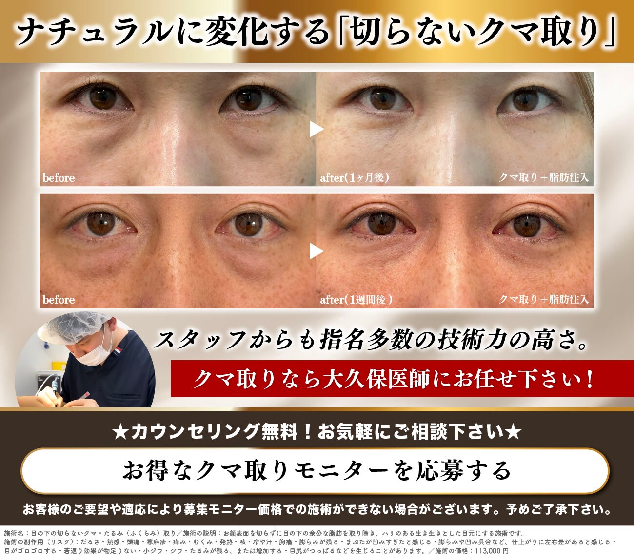 クマとりモニター