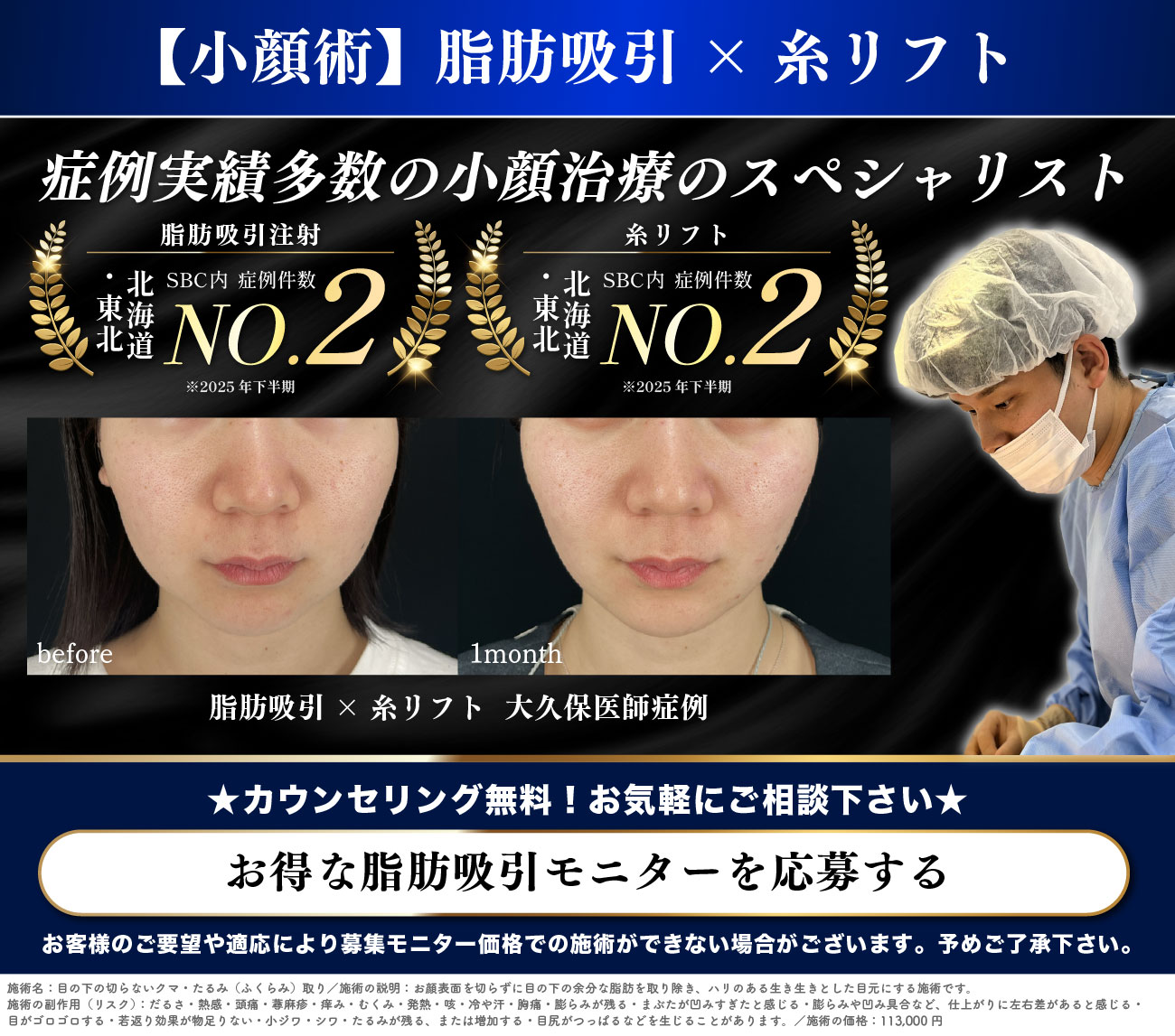 脂肪吸引モニター