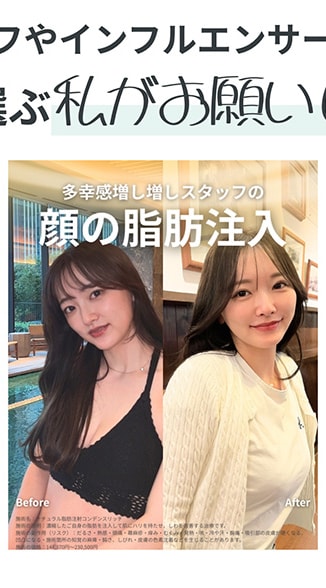 インスタグラム