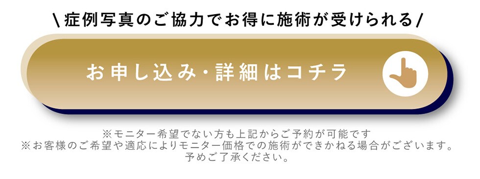 モニターお申し込み