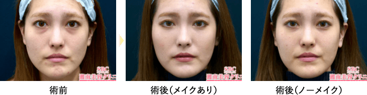 症例写真01