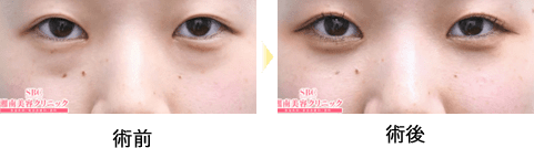 症例写真03