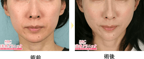 症例写真07