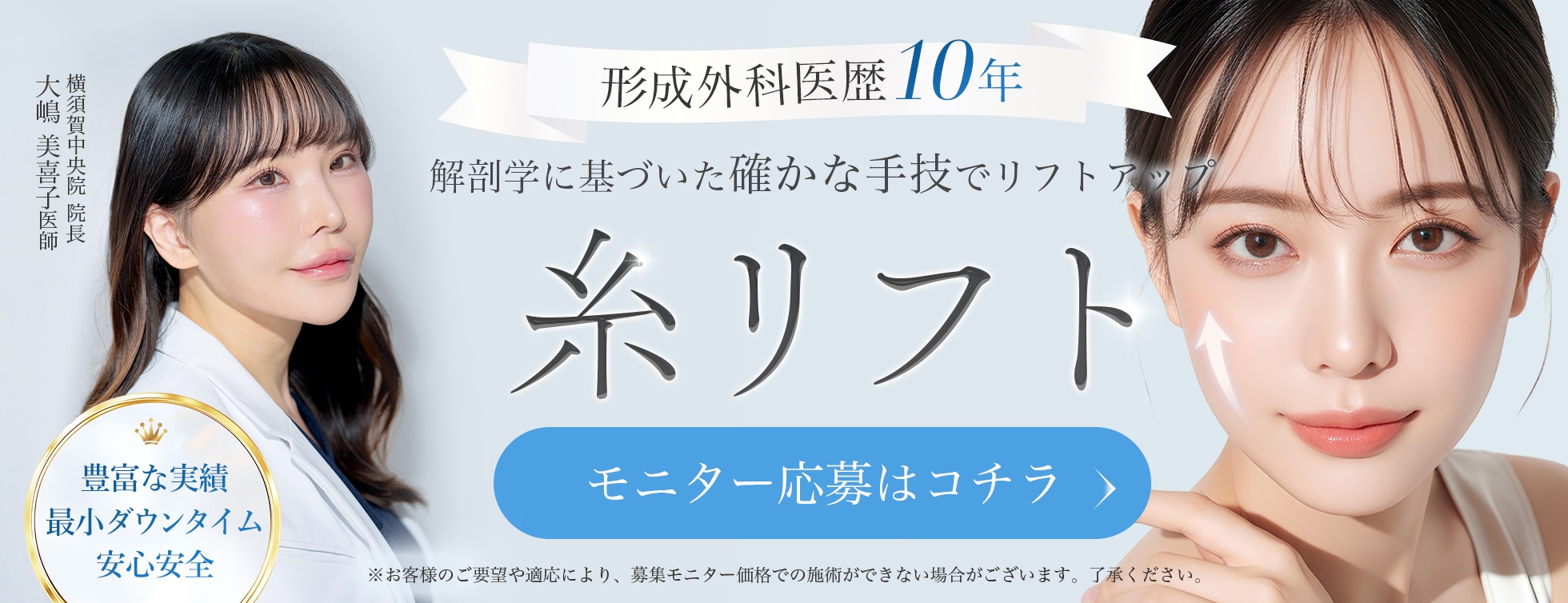 糸リフトモニター募集