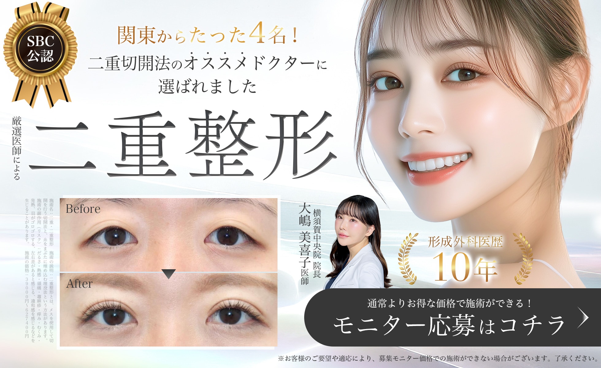 二重術モニター募集