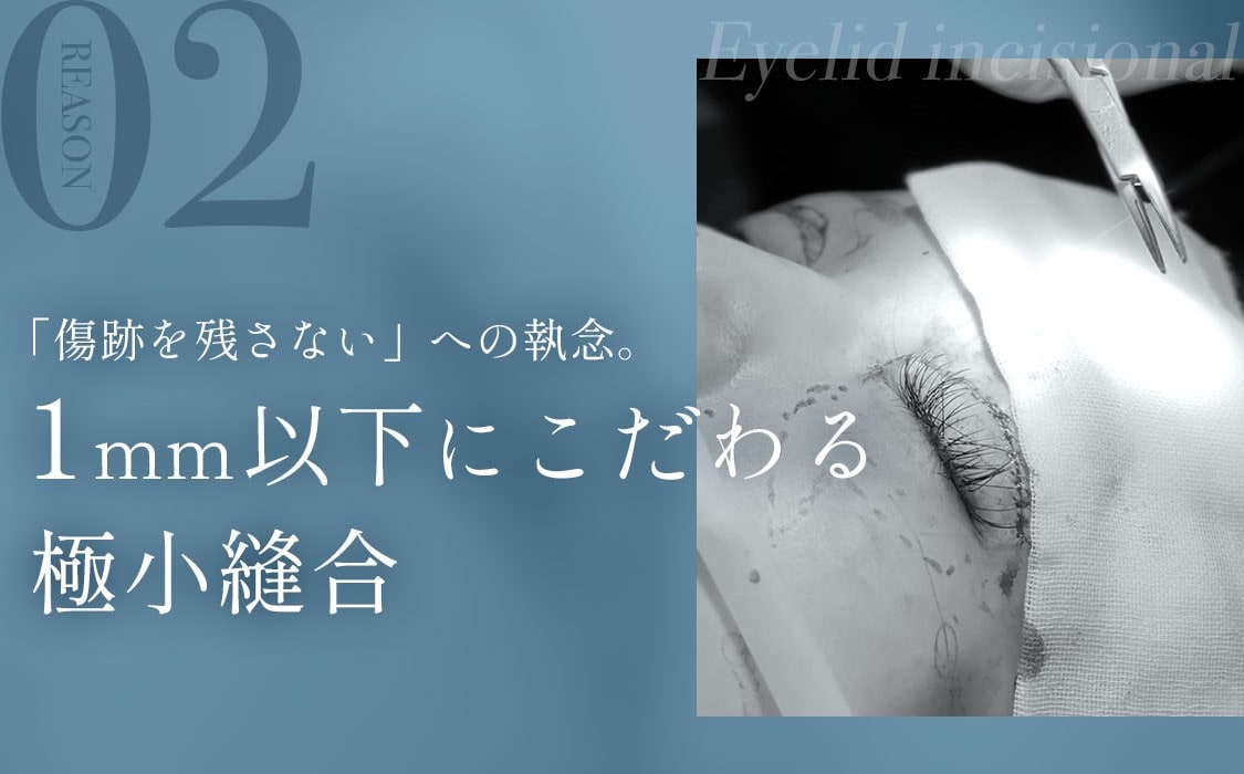選ばれる理由2:「傷跡を残さない」への執念。1mm以下にこだわる極小縫合
