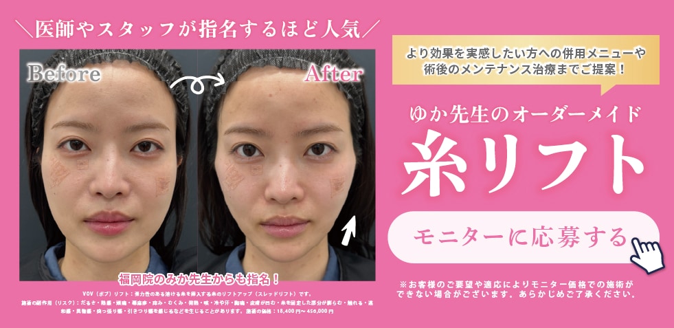 糸リフトモニター