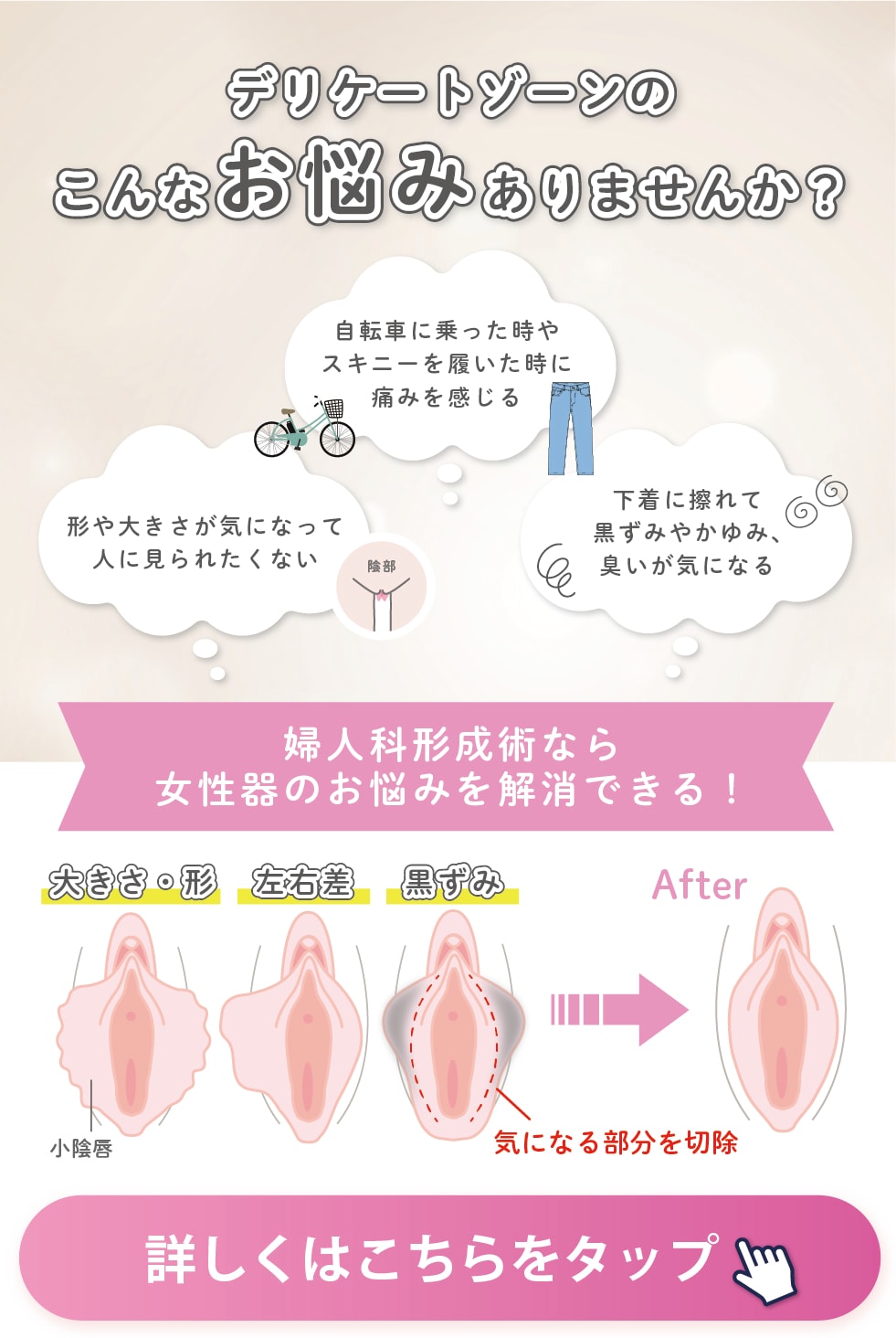 デリケートゾーンのお悩みありませんか