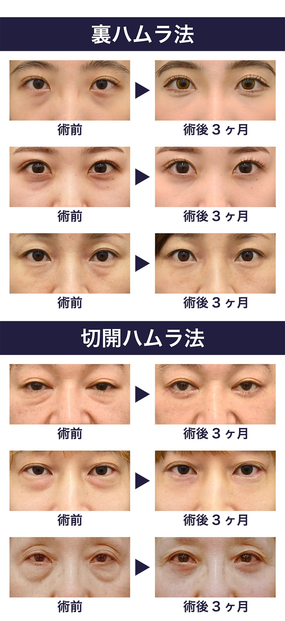 症例写真