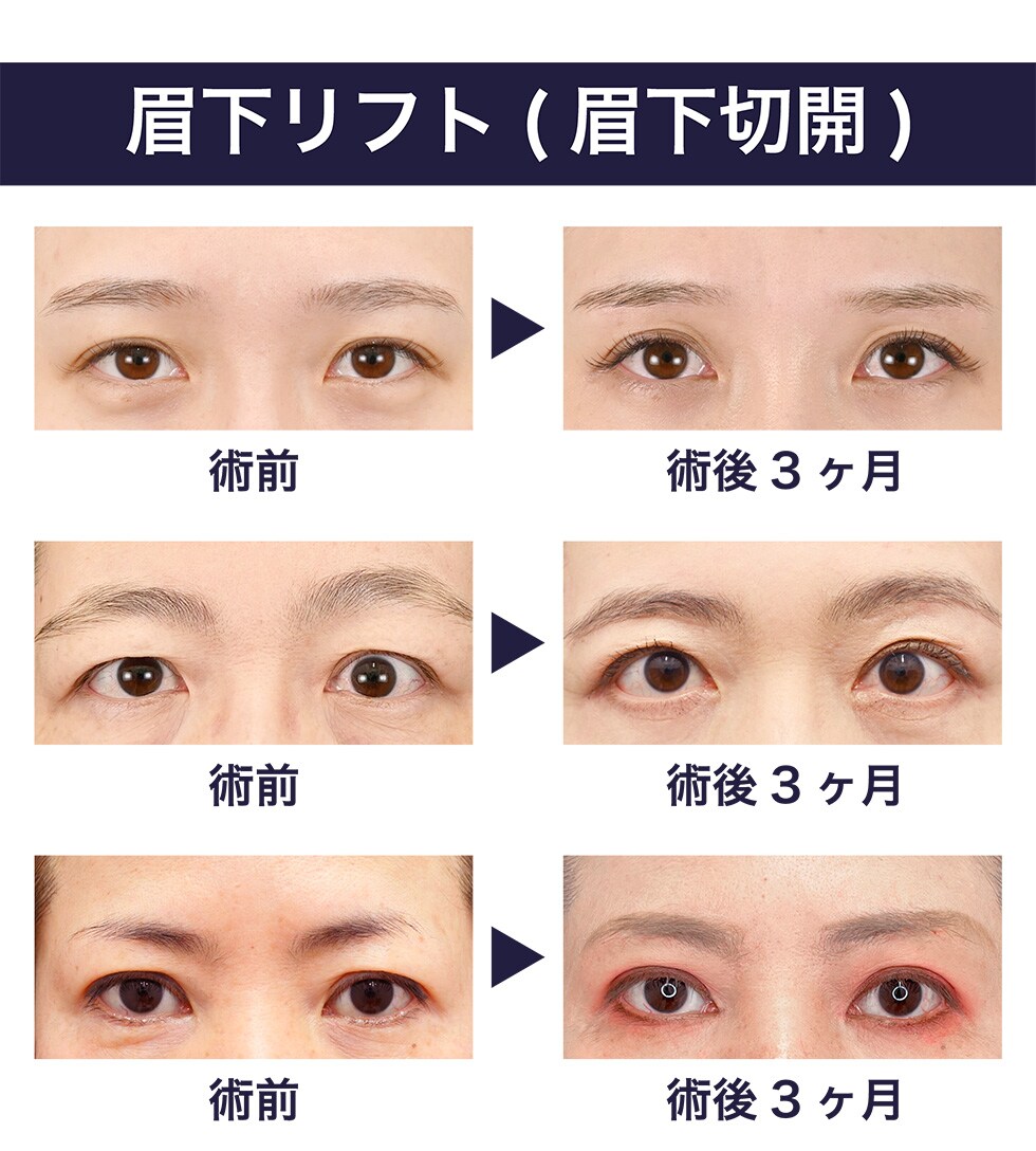 症例写真