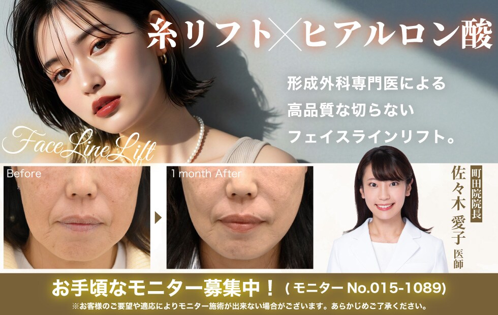 糸リフトヒアルロン酸