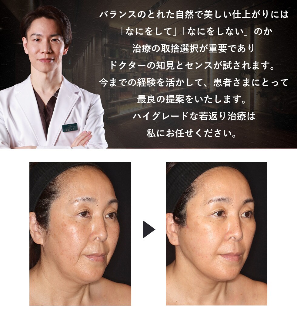 究極のエイジングケア