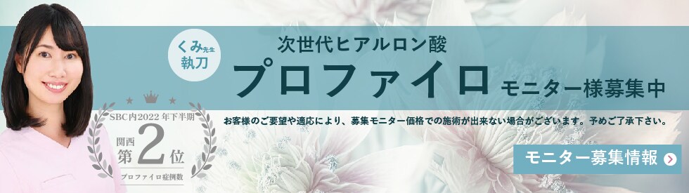 プロファイロ