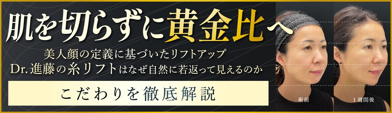 糸リフト