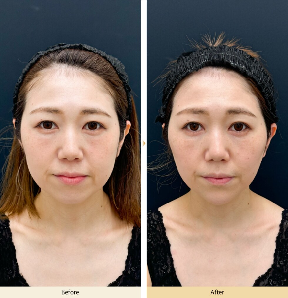 症例写真1