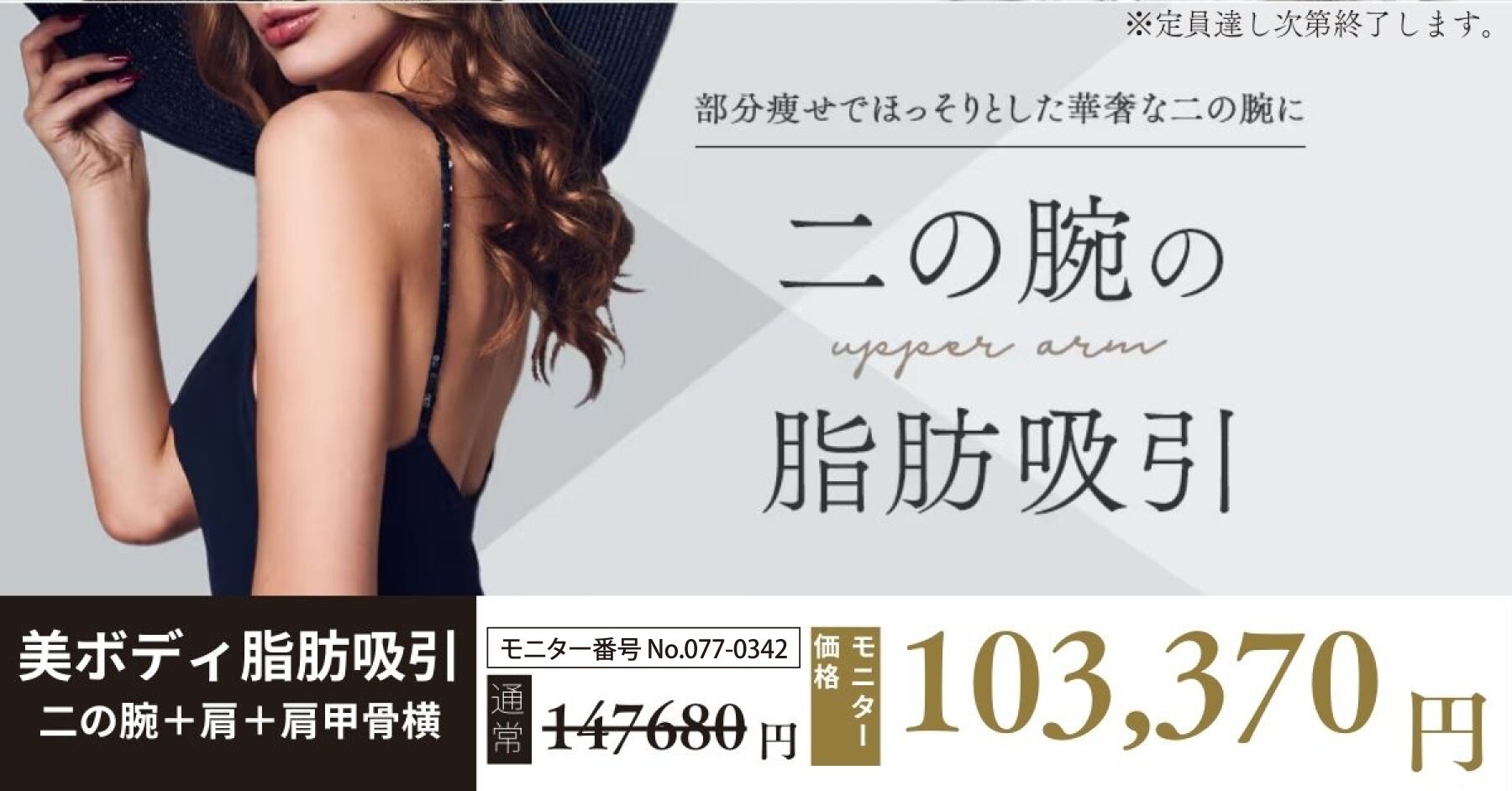 二の腕 脂肪吸引