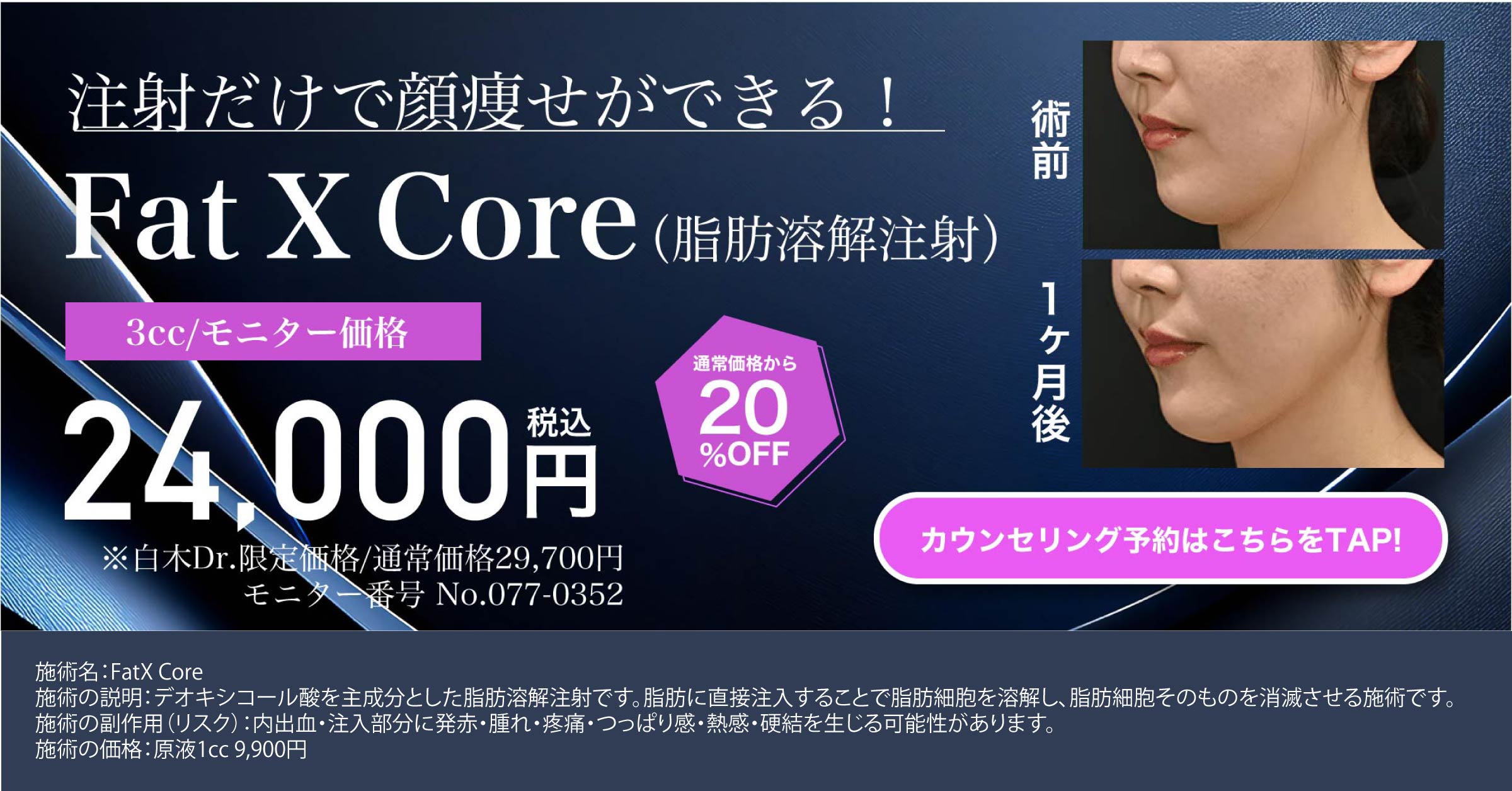 Fat X Core