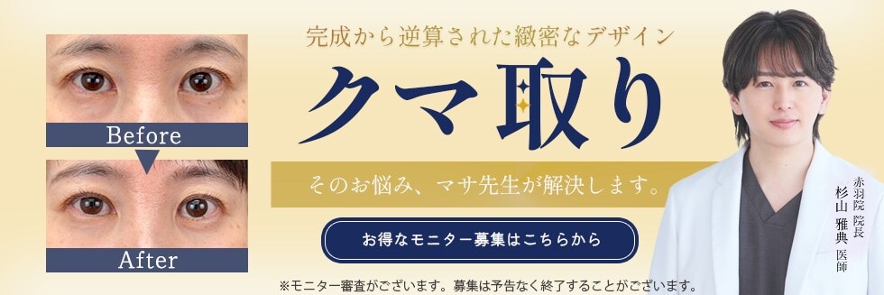 クマ取りモニター