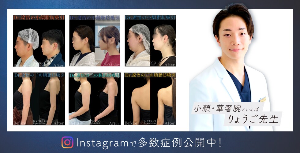インスタグラム